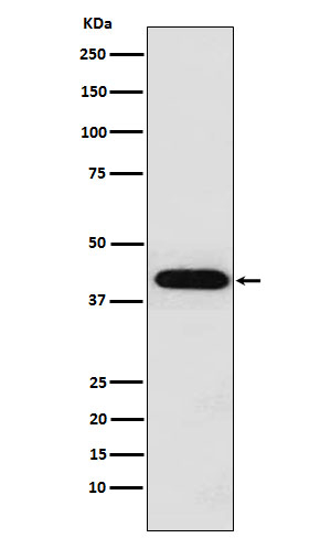 INHA Antibody in Western Blot (WB)