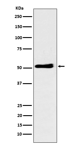 KPNA2 Antibody in Western Blot (WB)