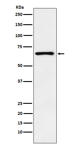 PTH1R Antibody in Western Blot (WB)