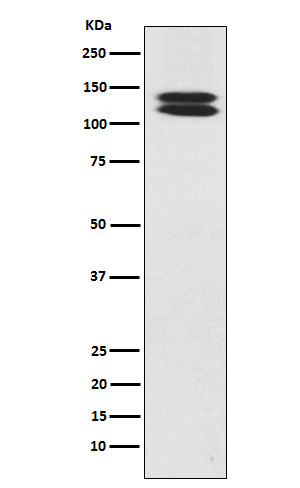 H-cadherin Antibody in Western Blot (WB)