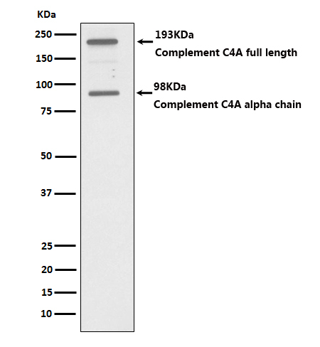 Complement C4a Antibody in Western Blot (WB)