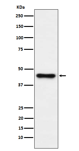 ABHD5 Antibody in Western Blot (WB)