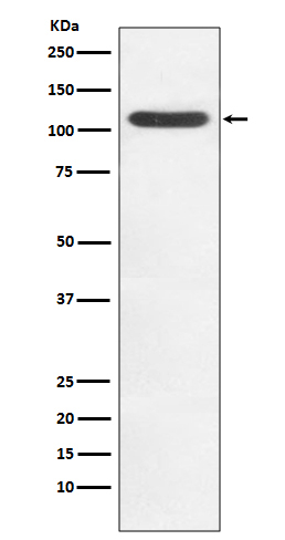 HIP1 Antibody in Western Blot (WB)