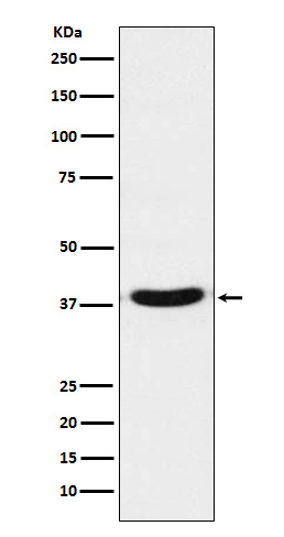 VPS26A Antibody in Western Blot (WB)