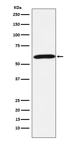Calsequestrin Antibody in Western Blot (WB)