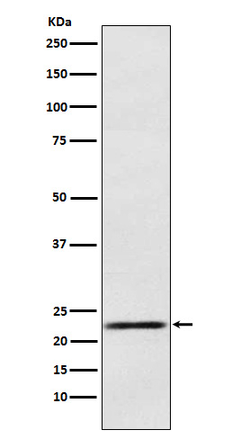 Prolactin Antibody in Western Blot (WB)