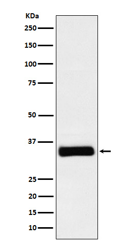 IGFBP2 Antibody in Western Blot (WB)