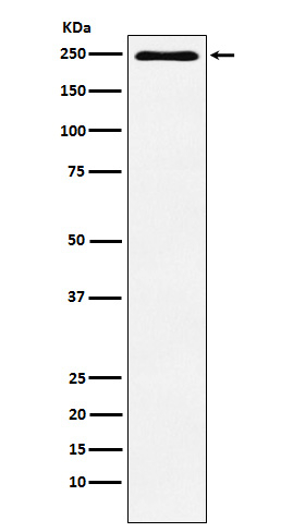 Plexin-A1 Antibody in Western Blot (WB)