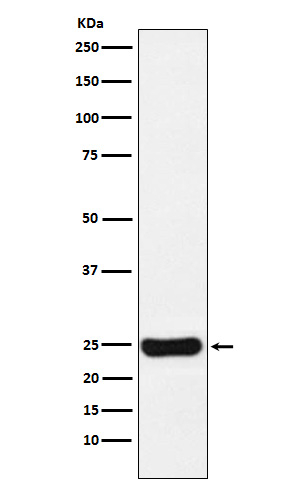 Cathepsin S Antibody in Western Blot (WB)