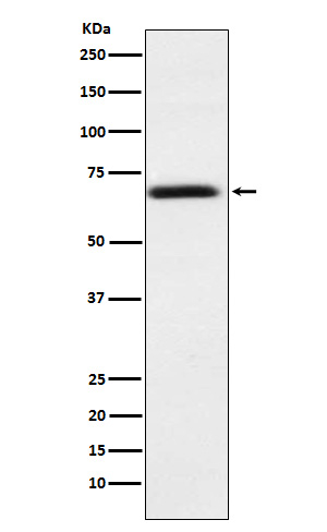 PMP70 Antibody in Western Blot (WB)