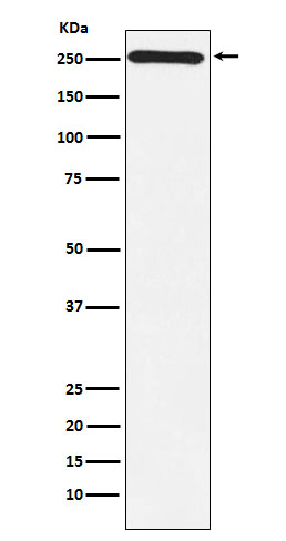 MYO7A Antibody in Western Blot (WB)
