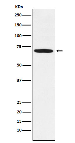LIMK1 Antibody in Western Blot (WB)