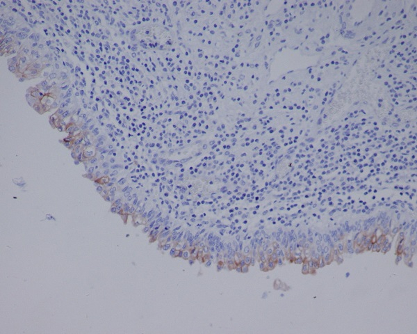 UPK3A Antibody in Immunohistochemistry (Paraffin) (IHC (P))