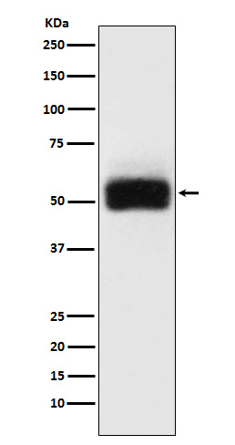 MMP17 Antibody in Western Blot (WB)