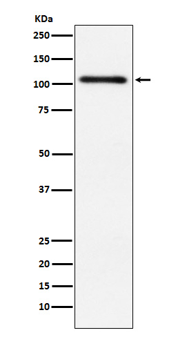 PRKD2 Antibody in Western Blot (WB)