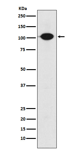 GABBR2 Antibody in Western Blot (WB)