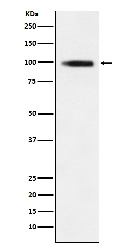GIT1 Antibody in Western Blot (WB)