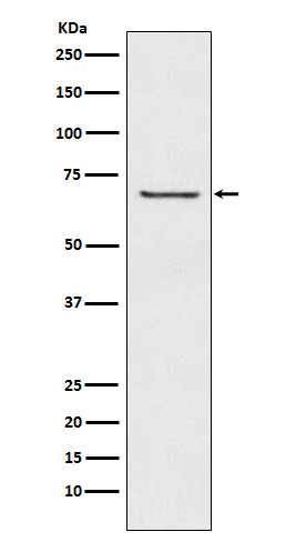 GABRB2 Antibody in Western Blot (WB)