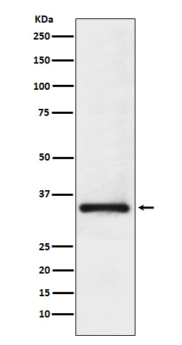 SNRPA Antibody in Western Blot (WB)