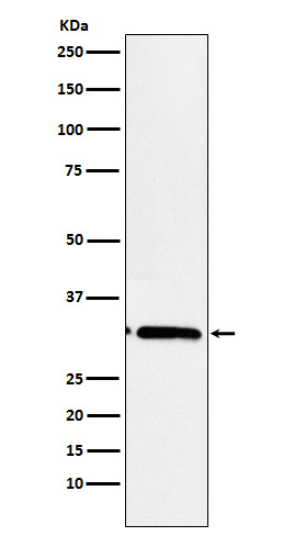 MAPRE3 Antibody in Western Blot (WB)