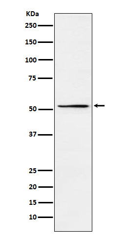 MEIS2 Antibody in Western Blot (WB)