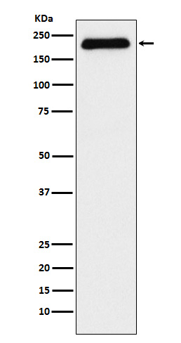 ATAD2 Antibody in Western Blot (WB)