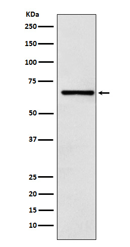 RCOR1 Antibody in Western Blot (WB)
