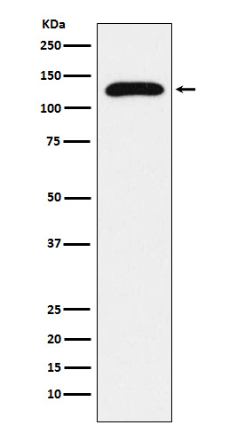 TRPC1 Antibody in Western Blot (WB)