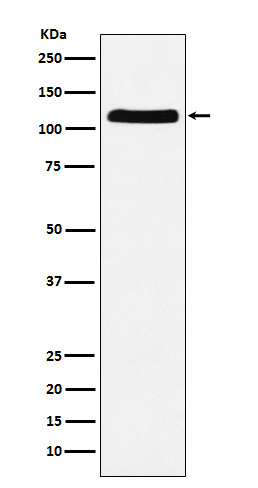 UBE1 Antibody in Western Blot (WB)