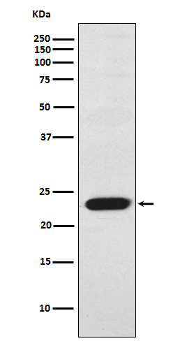 TNNI2 Antibody in Western Blot (WB)