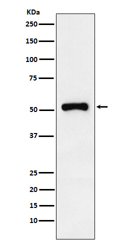 RAR gamma-1 Antibody in Western Blot (WB)