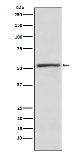 TBLR1 Antibody in Western Blot (WB)