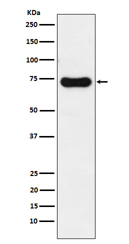 IRAK2 Antibody in Western Blot (WB)