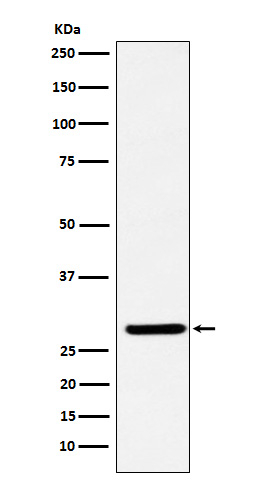 FHL2 Antibody in Western Blot (WB)