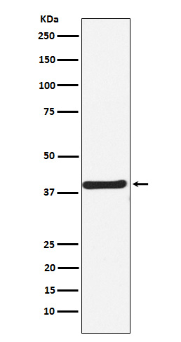 CaMKI Antibody in Western Blot (WB)