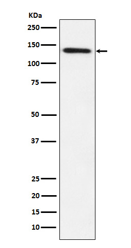 LPIN1 Antibody in Western Blot (WB)