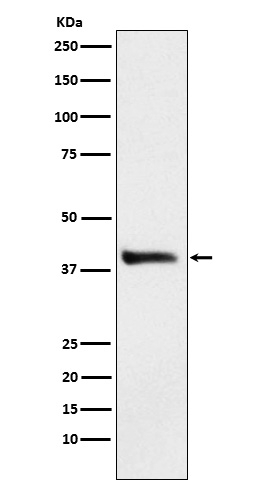 Alcohol Dehydrogenase 1A Antibody in Western Blot (WB)