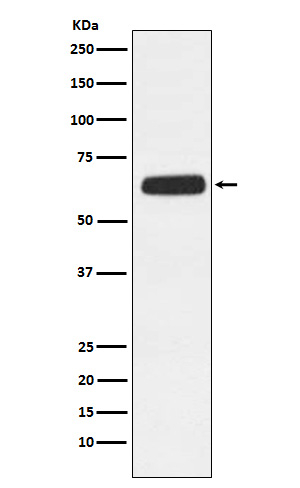 CD89 Antibody in Western Blot (WB)