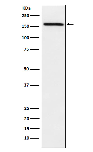 ADAMTS13 Antibody in Western Blot (WB)