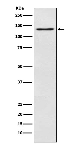 Mgea5 Antibody in Western Blot (WB)