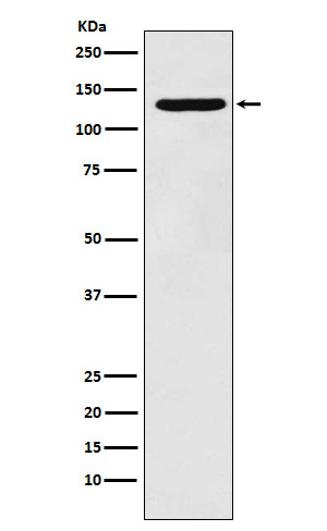 Pyruvate Carboxylase Antibody in Western Blot (WB)