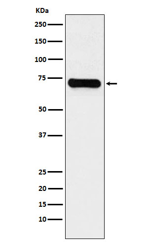 KARS Antibody in Western Blot (WB)