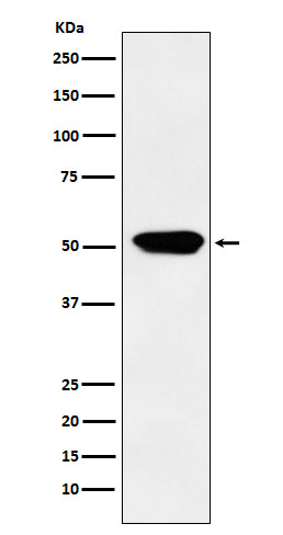 CYP4A11 Antibody in Western Blot (WB)