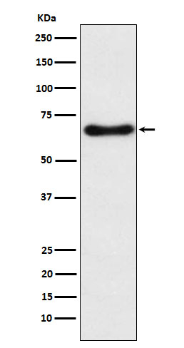 CYP24A1 Antibody in Western Blot (WB)