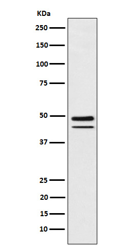 Brachyury Antibody in Western Blot (WB)