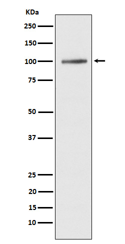 SERCA1 ATPase Antibody in Western Blot (WB)