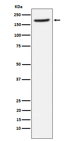 CD249 Antibody in Western Blot (WB)