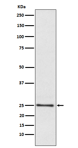 LYPLA1 Antibody in Western Blot (WB)