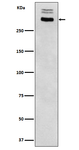 Thyroglobulin Antibody in Western Blot (WB)