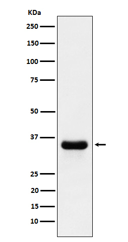 PSMD14 Antibody in Western Blot (WB)